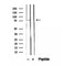 DF12402 staining Hela by IF/ICC. The sample were fixed with PFA and permeabilized in 0.1% Triton X-100,then blocked in 10% serum for 45 minutes at 25¡ãC. The primary antibody was diluted at 1/200 and incubated with the sample for 1 hour at 37¡ãC. An  Alexa Fluor 594 conjugated goat anti-rabbit IgG (H+L) Ab, diluted at 1/600, was used as the secondary antibod
