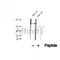 DF12403 at 1/100 staining Human pancreas cancer tissue by IHC-P. The sample was formaldehyde fixed and a heat mediated antigen retrieval step in citrate buffer was performed. The sample was then blocked and incubated with the antibody for 1.5 hours at 22¡ãC. An HRP conjugated goat anti-rabbit antibody was used as the secondary