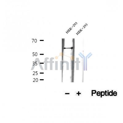 DF12403 at 1/100 staining Human pancreas cancer tissue by IHC-P. The sample was formaldehyde fixed and a heat mediated antigen retrieval step in citrate buffer was performed. The sample was then blocked and incubated with the antibody for 1.5 hours at 22¡ãC. An HRP conjugated goat anti-rabbit antibody was used as the secondary