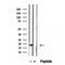 DF12404 at 1/100 staining Human pancreas cancer tissue by IHC-P. The sample was formaldehyde fixed and a heat mediated antigen retrieval step in citrate buffer was performed. The sample was then blocked and incubated with the antibody for 1.5 hours at 22¡ãC. An HRP conjugated goat anti-rabbit antibody was used as the secondary