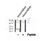 DF12407 at 1/100 staining Human Melanoma tissue by IHC-P. The sample was formaldehyde fixed and a heat mediated antigen retrieval step in citrate buffer was performed. The sample was then blocked and incubated with the antibody for 1.5 hours at 22¡ãC. An HRP conjugated goat anti-rabbit antibody was used as the secondary