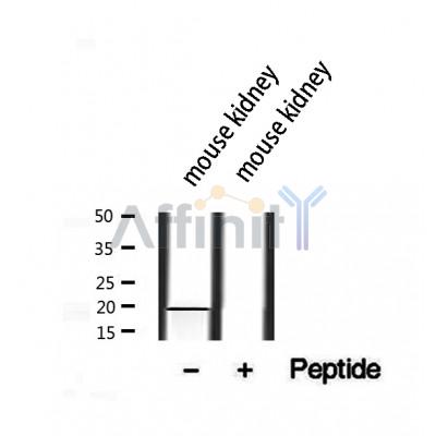 DF12407 at 1/100 staining Human Melanoma tissue by IHC-P. The sample was formaldehyde fixed and a heat mediated antigen retrieval step in citrate buffer was performed. The sample was then blocked and incubated with the antibody for 1.5 hours at 22¡ãC. An HRP conjugated goat anti-rabbit antibody was used as the secondary