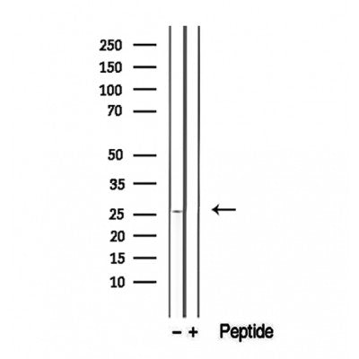 Western blot analysis of extracts from Hela, using GSTM4 Antibody. The lane on the left was treated with blocking peptide.