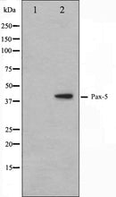 Western blot analysis on 293 cell lysate using Pax-5 Antibody. The lane on the left is treated with the antigen-specific peptide.
