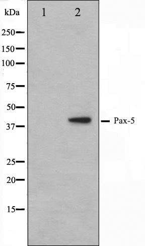 Western blot analysis on 293 cell lysate using Pax-5 Antibody. The lane on the left is treated with the antigen-specific peptide.
