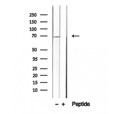 DF12412 staining Hela by IF/ICC. The sample were fixed with PFA and permeabilized in 0.1% Triton X-100,then blocked in 10% serum for 45 minutes at 25¡ãC. The primary antibody was diluted at 1/200 and incubated with the sample for 1 hour at 37¡ãC. An  Alexa Fluor 594 conjugated goat anti-rabbit IgG (H+L) Ab, diluted at 1/600, was used as the secondary antibod