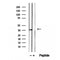 DF12413 staining Hela by IF/ICC. The sample were fixed with PFA and permeabilized in 0.1% Triton X-100,then blocked in 10% serum for 45 minutes at 25¡ãC. The primary antibody was diluted at 1/200 and incubated with the sample for 1 hour at 37¡ãC. An  Alexa Fluor 594 conjugated goat anti-rabbit IgG (H+L) Ab, diluted at 1/600, was used as the secondary antibod