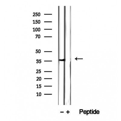 DF12413 staining Hela by IF/ICC. The sample were fixed with PFA and permeabilized in 0.1% Triton X-100,then blocked in 10% serum for 45 minutes at 25¡ãC. The primary antibody was diluted at 1/200 and incubated with the sample for 1 hour at 37¡ãC. An  Alexa Fluor 594 conjugated goat anti-rabbit IgG (H+L) Ab, diluted at 1/600, was used as the secondary antibod