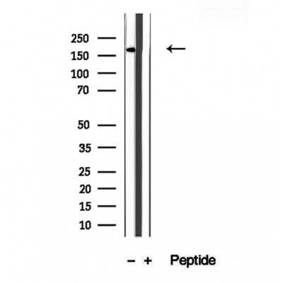 Western blot analysis of extracts from 3t3, using KIDINS220 Antibody. The lane on the left was treated with blocking peptide.