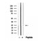 DF12416 at 1/100 staining Human pancreas cancer tissue by IHC-P. The sample was formaldehyde fixed and a heat mediated antigen retrieval step in citrate buffer was performed. The sample was then blocked and incubated with the antibody for 1.5 hours at 22¡ãC. An HRP conjugated goat anti-rabbit antibody was used as the secondary