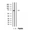 DF12419 staining Hela by IF/ICC. The sample were fixed with PFA and permeabilized in 0.1% Triton X-100,then blocked in 10% serum for 45 minutes at 25¡ãC. The primary antibody was diluted at 1/200 and incubated with the sample for 1 hour at 37¡ãC. An  Alexa Fluor 594 conjugated goat anti-rabbit IgG (H+L) Ab, diluted at 1/600, was used as the secondary antibod