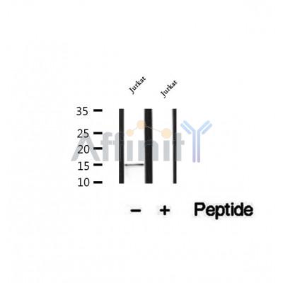 DF12424 at 1/100 staining Mouse lung tissue by IHC-P. The sample was formaldehyde fixed and a heat mediated antigen retrieval step in citrate buffer was performed. The sample was then blocked and incubated with the antibody for 1.5 hours at 22¡ãC. An HRP conjugated goat anti-rabbit antibody was used as the secondary