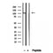 Western blot analysis of extracts from MCF7, using NAT10 Antibody. The lane on the left was treated with blocking peptide.