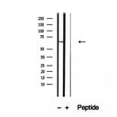 Western blot analysis of extracts from 3T3, using NFKBIZ Antibody. The lane on the left was treated with blocking peptide.