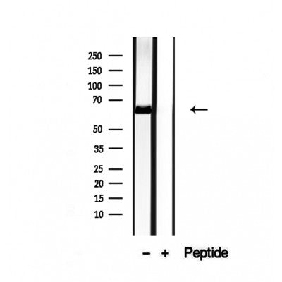 DF12430 at 1/100 staining Mouse liver tissue by IHC-P. The sample was formaldehyde fixed and a heat mediated antigen retrieval step in citrate buffer was performed. The sample was then blocked and incubated with the antibody for 1.5 hours at 22¡ãC. An HRP conjugated goat anti-rabbit antibody was used as the secondary