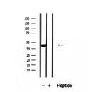 Western blot analysis of extracts from various samples, using OXA1L Antibody.
 Lane 1: HepG2 treated with blocking peptide;
 Lane 2: HepG2;
Lane 3: Hela.