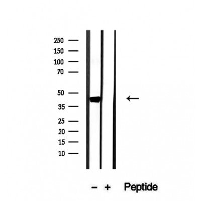 Western blot analysis of extracts from various samples, using OXA1L Antibody.
 Lane 1: HepG2 treated with blocking peptide;
 Lane 2: HepG2;
Lane 3: Hela.