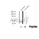 DF12443 at 1/100 staining Human pancreas cancer tissue by IHC-P. The sample was formaldehyde fixed and a heat mediated antigen retrieval step in citrate buffer was performed. The sample was then blocked and incubated with the antibody for 1.5 hours at 22¡ãC. An HRP conjugated goat anti-rabbit antibody was used as the secondary