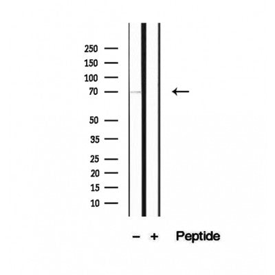 Western blot analysis of extracts from 3t3, using PCCA Antibody. Lane 1 was treated with the blocking peptide.