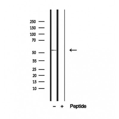 DF12449 staining Hela by IF/ICC. The sample were fixed with PFA and permeabilized in 0.1% Triton X-100,then blocked in 10% serum for 45 minutes at 25¡ãC. The primary antibody was diluted at 1/200 and incubated with the sample for 1 hour at 37¡ãC. An  Alexa Fluor 594 conjugated goat anti-rabbit IgG (H+L) Ab, diluted at 1/600, was used as the secondary antibod