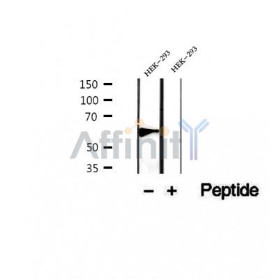 DF12451 at 1/100 staining Mouse liver tissue by IHC-P. The sample was formaldehyde fixed and a heat mediated antigen retrieval step in citrate buffer was performed. The sample was then blocked and incubated with the antibody for 1.5 hours at 22¡ãC. An HRP conjugated goat anti-rabbit antibody was used as the secondary