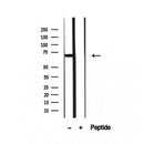 Western blot analysis of extracts from 3t3, using PHF19 Antibody. Lane 1 was treated with the blocking peptide.