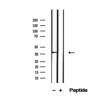 Western blot analysis of extracts from Rat  liver, using PIK3IP1 Antibody. The lane on the left was treated with blocking peptide.