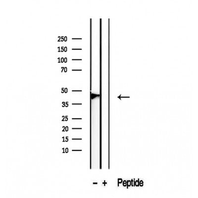 DF12456 at 1/100 staining Mouse brain tissue by IHC-P. The sample was formaldehyde fixed and a heat mediated antigen retrieval step in citrate buffer was performed. The sample was then blocked and incubated with the antibody for 1.5 hours at 22¡ãC. An HRP conjugated goat anti-rabbit antibody was used as the secondary