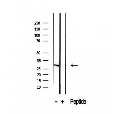 Western blot analysis of extracts from B16F10, using RAB12 Antibody. The lane on the left was treated with blocking peptide.