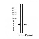 DF12460 staining Hela by IF/ICC. The sample were fixed with PFA and permeabilized in 0.1% Triton X-100,then blocked in 10% serum for 45 minutes at 25¡ãC. The primary antibody was diluted at 1/200 and incubated with the sample for 1 hour at 37¡ãC. An  Alexa Fluor 594 conjugated goat anti-rabbit IgG (H+L) Ab, diluted at 1/600, was used as the secondary antibod
