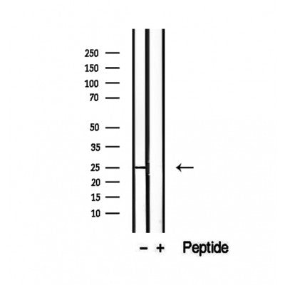 DF12461 staining Hela by IF/ICC. The sample were fixed with PFA and permeabilized in 0.1% Triton X-100,then blocked in 10% serum for 45 minutes at 25¡ãC. The primary antibody was diluted at 1/200 and incubated with the sample for 1 hour at 37¡ãC. An  Alexa Fluor 594 conjugated goat anti-rabbit IgG (H+L) Ab, diluted at 1/600, was used as the secondary antibod