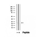 Western blot analysis of extracts from Mouse brain, using RBBP9 Antibody. Lane 1 was treated with the blocking peptide.