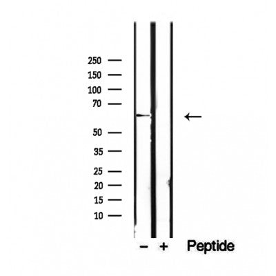 DF12465 staining Hela by IF/ICC. The sample were fixed with PFA and permeabilized in 0.1% Triton X-100,then blocked in 10% serum for 45 minutes at 25¡ãC. The primary antibody was diluted at 1/200 and incubated with the sample for 1 hour at 37¡ãC. An  Alexa Fluor 594 conjugated goat anti-rabbit IgG (H+L) Ab, diluted at 1/600, was used as the secondary antibod