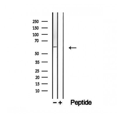 Western blot analysis of extracts from K562, using Seladin 1 Antibody. The lane on the left was treated with blocking peptide.