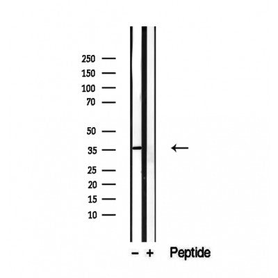 DF12473 staining Hela by IF/ICC. The sample were fixed with PFA and permeabilized in 0.1% Triton X-100,then blocked in 10% serum for 45 minutes at 25¡ãC. The primary antibody was diluted at 1/200 and incubated with the sample for 1 hour at 37¡ãC. An  Alexa Fluor 594 conjugated goat anti-rabbit IgG (H+L) Ab, diluted at 1/600, was used as the secondary antibod