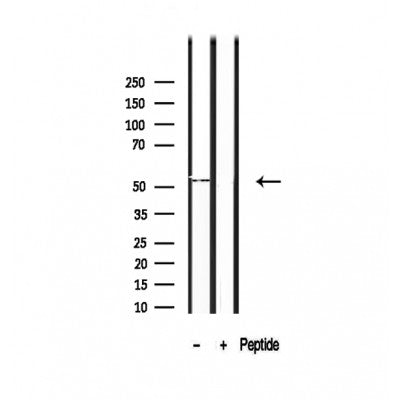 Western blot analysis of extracts from Pc12, using SHMT1 Antibody. The lane on the left was treated with blocking peptide.