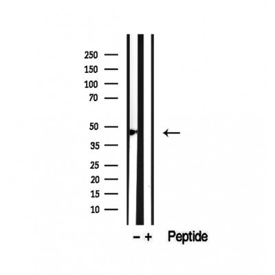 DF12477 staining Hela by IF/ICC. The samples were fixed with PFA and permeabilized in 0.1% Triton X-100,then blocked in 10% serum for 45 minutes at 25¡ãC. Samples were then incubated with primary Ab(DF12477 1:200) and mouse anti-beta tubulin Ab(T0023 1:200) for 1 hour at 37¡ãC. An  AlexaFluor594 conjugated goat anti-rabbit IgG(H+L) Ab(S0006 1:200 Red) and an AlexaFluor488 conjugated goat anti-mouse IgG(H+L) Ab(S0017 1:600 Green) were used as the secondary antibod
