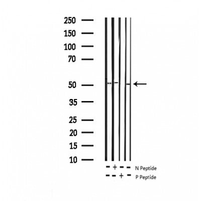 AF3379 at 1/100 staining Rat heart tissue by IHC-P. The sample was formaldehyde fixed and a heat mediated antigen retrieval step in citrate buffer was performed. The sample was then blocked and incubated with the antibody for 1.5 hours at 22¡ãC. An HRP conjugated goat anti-rabbit antibody was used as the secondary