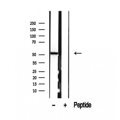 Western blot analysis of extracts from Mouse brain, using SUOX Antibody. The lane on the left was treated with blocking peptide.
