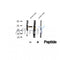 DF12483 at 1/100 staining Human thyroid cancer tissue by IHC-P. The sample was formaldehyde fixed and a heat mediated antigen retrieval step in citrate buffer was performed. The sample was then blocked and incubated with the antibody for 1.5 hours at 22¡ãC. An HRP conjugated goat anti-rabbit antibody was used as the secondary