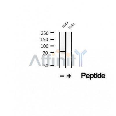DF12484 staining Hela by IF/ICC. The samples were fixed with PFA and permeabilized in 0.1% Triton X-100,then blocked in 10% serum for 45 minutes at 25¡ãC. Samples were then incubated with primary Ab(DF12484 1:200) and mouse anti-beta tubulin Ab(T0023 1:200) for 1 hour at 37¡ãC. An  AlexaFluor594 conjugated goat anti-rabbit IgG(H+L) Ab(S0006 1:200 Red) and an AlexaFluor488 conjugated goat anti-mouse IgG(H+L) Ab(S0017 1:600 Green) were used as the secondary antibod