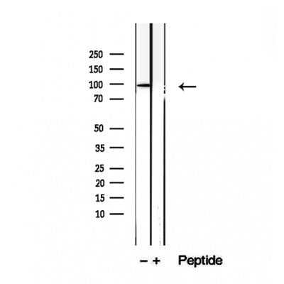 DF12486 at 1/100 staining Mouse liver tissue by IHC-P. The sample was formaldehyde fixed and a heat mediated antigen retrieval step in citrate buffer was performed. The sample was then blocked and incubated with the antibody for 1.5 hours at 22¡ãC. An HRP conjugated goat anti-rabbit antibody was used as the secondary