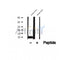 DF12487 at 1/100 staining Human thyroid cancer tissue by IHC-P. The sample was formaldehyde fixed and a heat mediated antigen retrieval step in citrate buffer was performed. The sample was then blocked and incubated with the antibody for 1.5 hours at 22¡ãC. An HRP conjugated goat anti-rabbit antibody was used as the secondary
