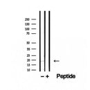Western blot analysis of extracts from Rat liver, using TMEM70 Antibody. The lane on the left was treated with blocking peptide.
