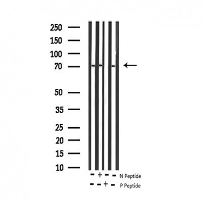 AF3380 staining HepG2 by IF/ICC. The sample were fixed with PFA and permeabilized in 0.1% Triton X-100,then blocked in 10% serum for 45 minutes at 25¡ãC. The primary antibody was diluted at 1/200 and incubated with the sample for 1 hour at 37¡ãC. An  Alexa Fluor 594 conjugated goat anti-rabbit IgG (H+L) Ab, diluted at 1/600, was used as the secondary antibod