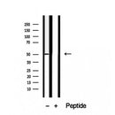 Western blot analysis of extracts from Hela, using TRIM14 Antibody. The lane on the left was treated with blocking peptide.