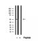 Western blot analysis of extracts from Hela, using TRIM14 Antibody. The lane on the left was treated with blocking peptide.