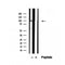 Western blot analysis of extracts from MCF7, using TRPC4AP Antibody. The lane on the left was treated with blocking peptide.