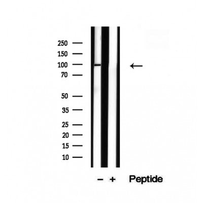 Western blot analysis of extracts from MCF7, using TRPC4AP Antibody. The lane on the left was treated with blocking peptide.