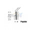 DF12493 at 1/100 staining Human thyroid cancer tissue by IHC-P. The sample was formaldehyde fixed and a heat mediated antigen retrieval step in citrate buffer was performed. The sample was then blocked and incubated with the antibody for 1.5 hours at 22¡ãC. An HRP conjugated goat anti-rabbit antibody was used as the secondary